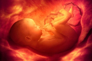 Intervención fetal intra uterina salva la vida de mujer e hijo
